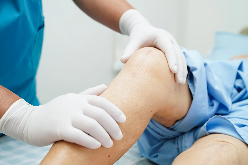 Affordable Knee Surgery Everything You Need to Know About Lowering Costs