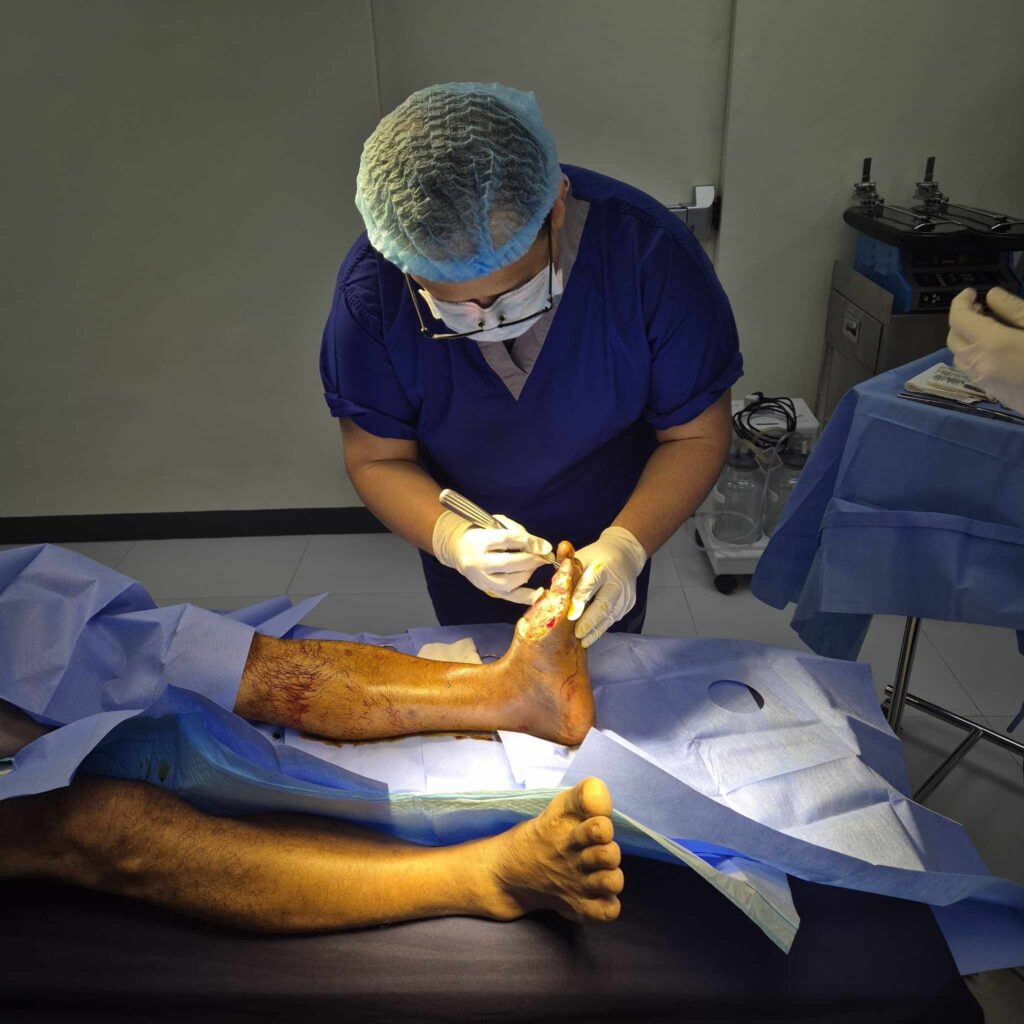 Professional Debridement Services in Quezon City Everything You Need to Know