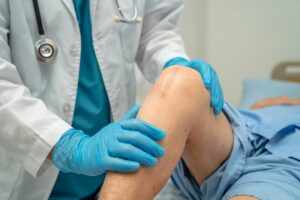 Doctor for Knee Surgery How to Find the Right Specialist for Your Needs
