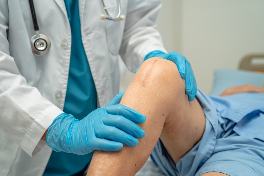 Doctor for Knee Surgery How to Find the Right Specialist for Your Needs