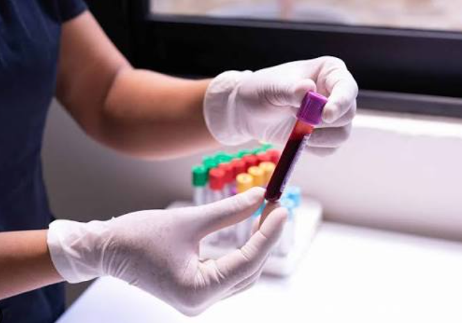 HBOC Test Philippines